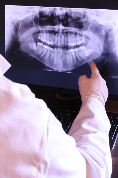 Best Dental Abscess Treatment in Wallace, FL